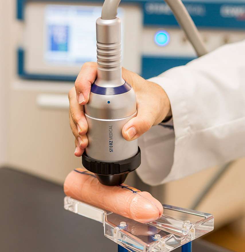 Ondas de choque en el pene.