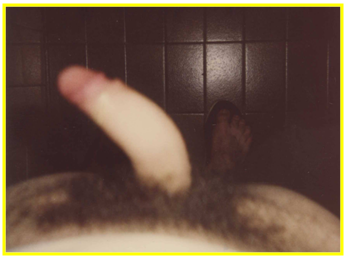 Autofotografia que demuestra una severa incurvación hacia la izquierda