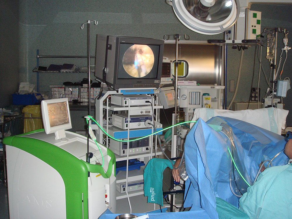 Láser verde en próstata