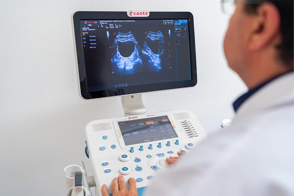 Ecografía urología Rodriguez Vela